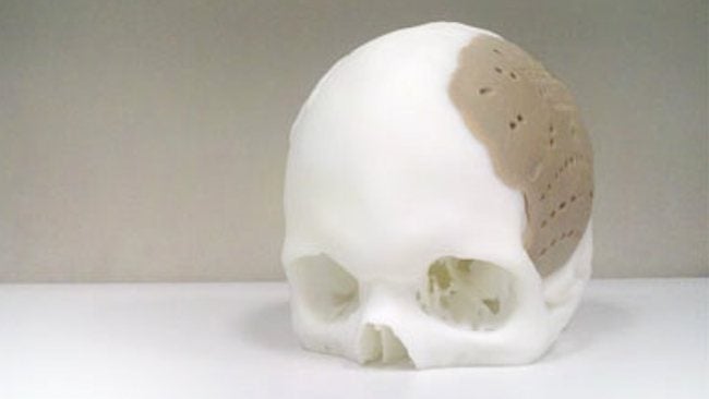 skull.jpg