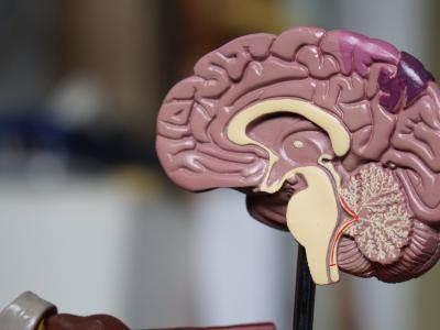 Bruce Linton Talks Psychedelics Investments, Microdosing And LSD: